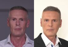 Plasztikával éveket fiatalodott a magyar James Bond